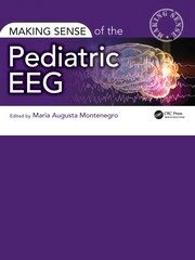 Making Sense of the Pediatric EEG