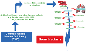 Common Immune Deficiency and Bronchiectasis