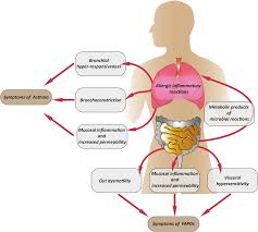 Symptoms of Asthma diagram