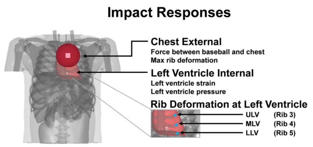 Figure 2.Impact responses analyzed from the computationalmodel. Chest internal responses, left ventricle internalresponse, and detailed chest external response as rib deforma-tions at the left ventricle region. ULV: Upper left ventricle,MLV: Middle left ventricle, and LLV: Lower left ventricle.